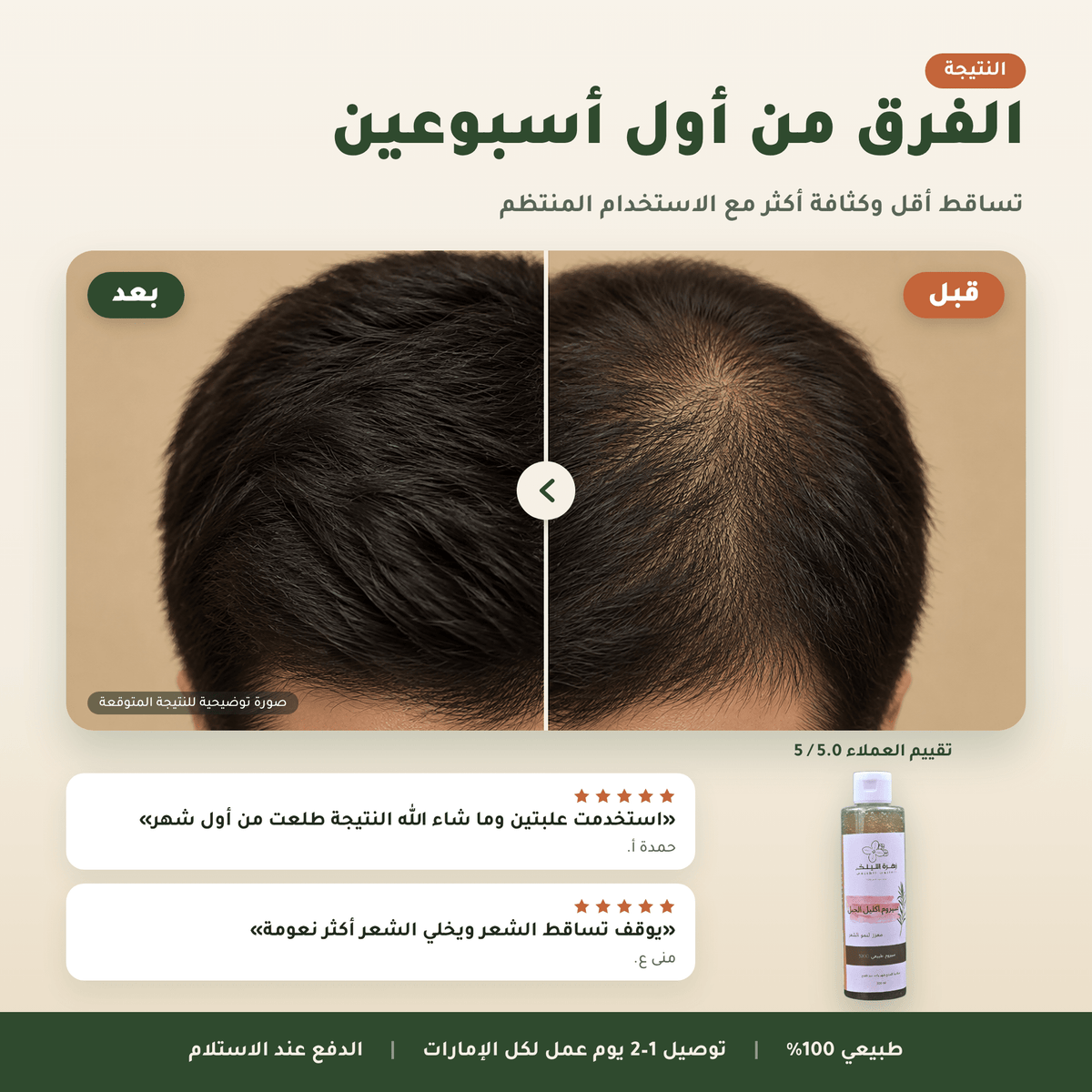 سيروم إكليل الجبل العناية بالشعر