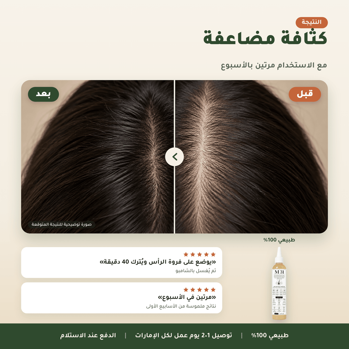 سيروم M31 لفروة الرأس العناية بالشعر